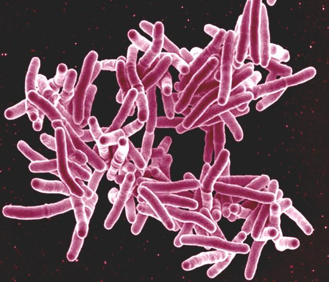 Sobre la Tuberculosis » Innotub
